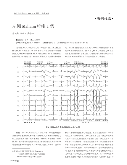 左侧Mahaim纤维1例